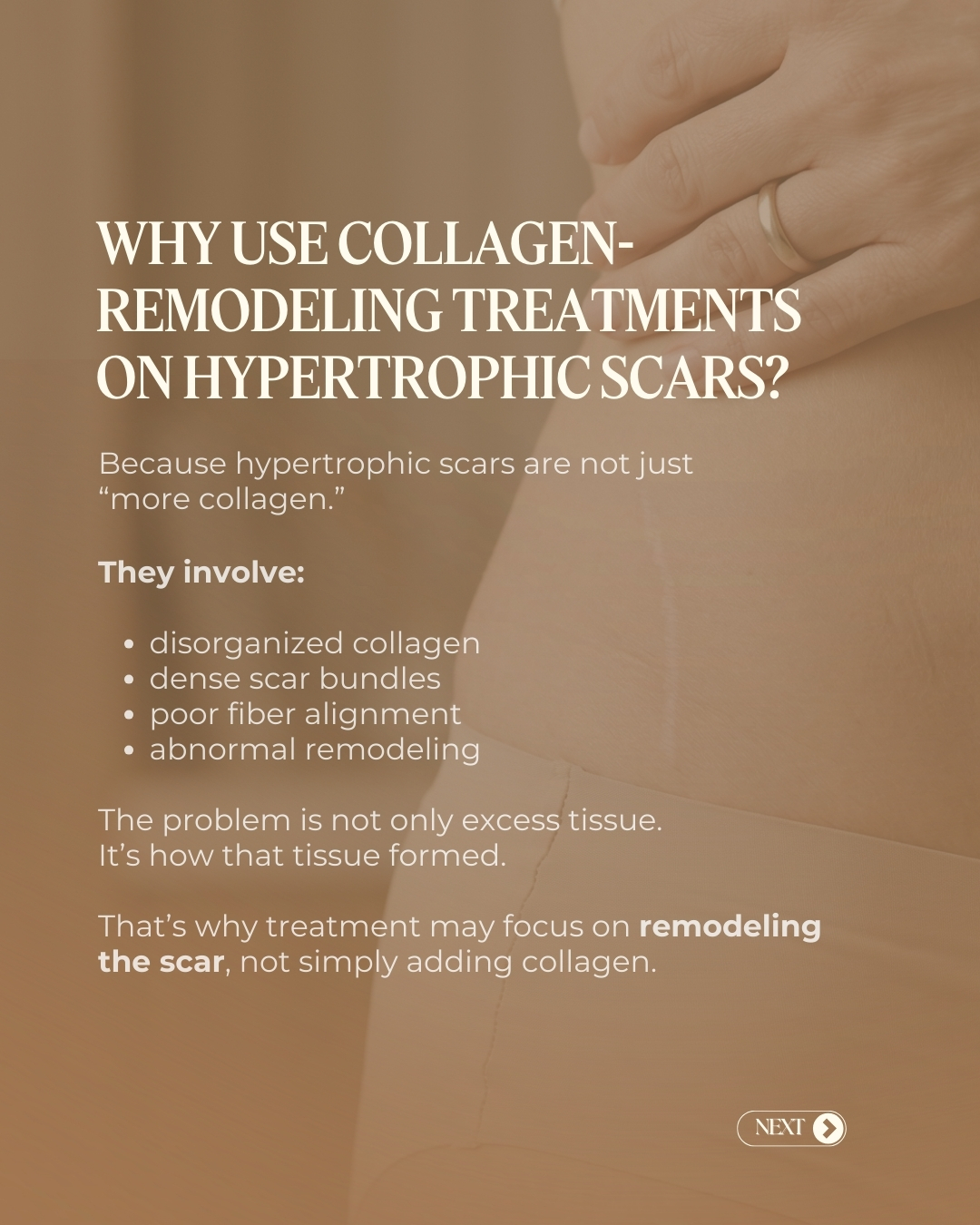 Epiere Skin HIFU consultation campaign