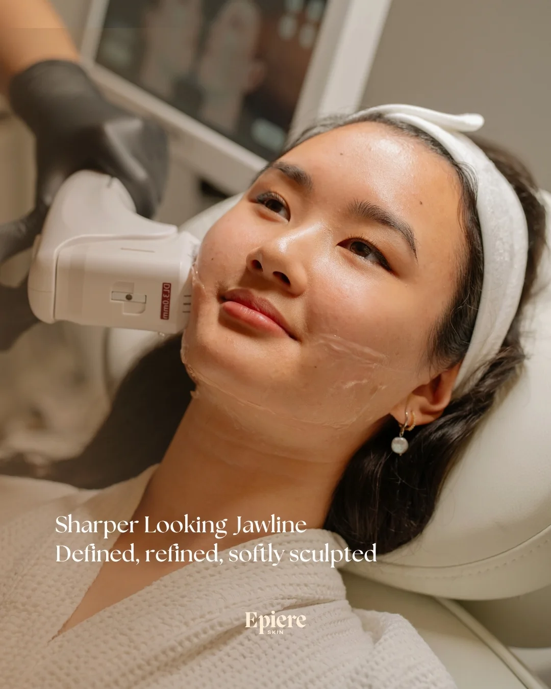 Epiere HIFU treatment campaign