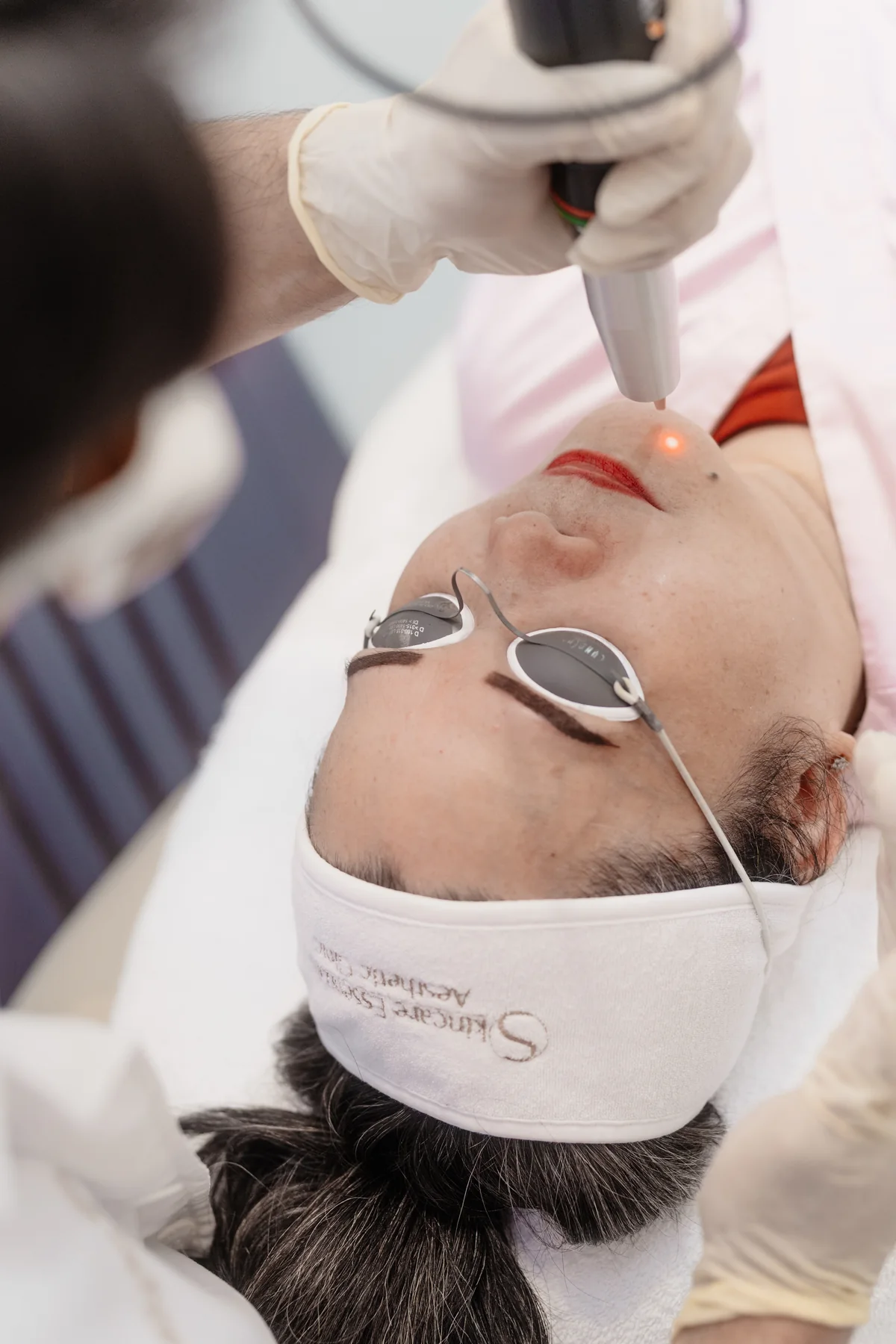 Laser treatment photographed at Skin Care Essentials